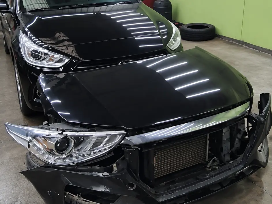 Black car with front-end accident damage, bumper removed